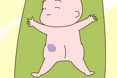 【胎记答疑】蒙古斑疾病通常会出现在哪些部位？